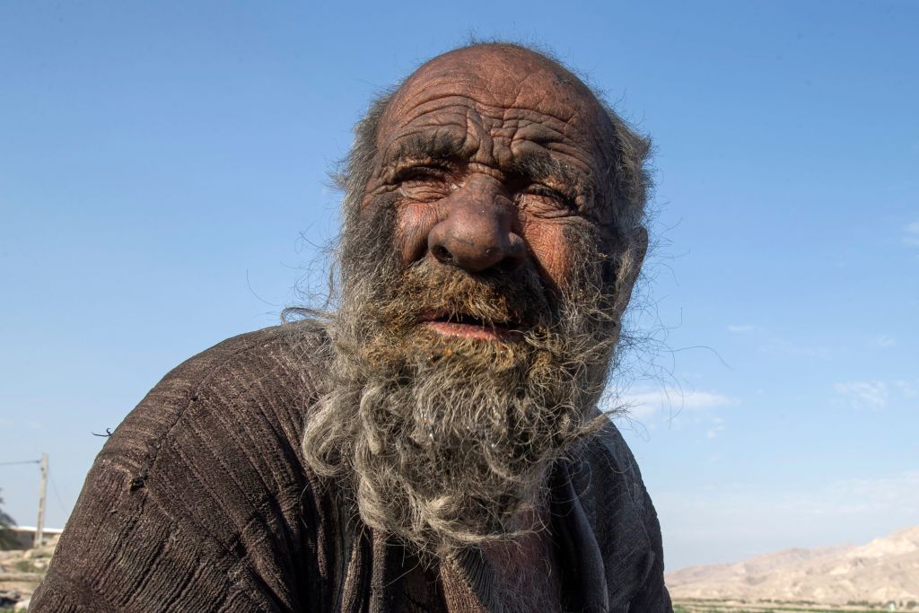 ‘World’s Dirtiest Man’ Dies at 94