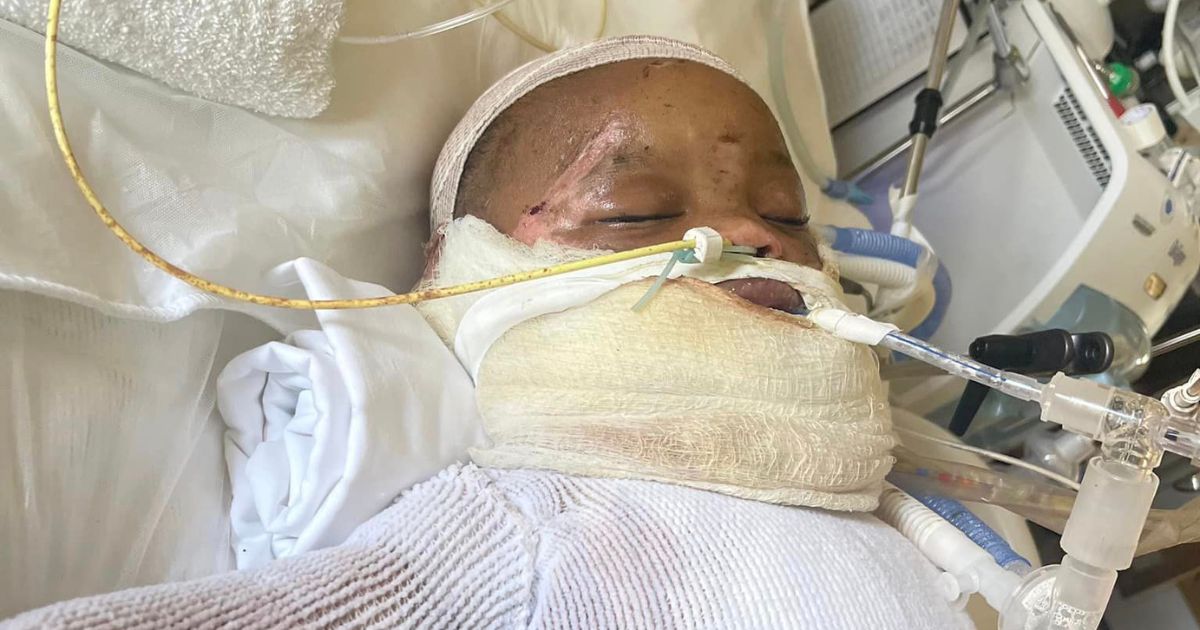 Freak Accident Involving Vicks VapoRub Leaves Baby With Third-Degree Burns on 40 Percent of Body
