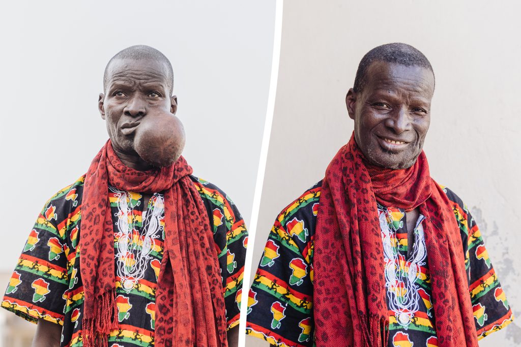 Teacher Returns To Classroom Unrecognizable After Life-Changing Surgery‌
‌