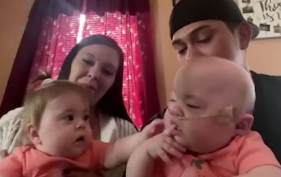 1 LB Premature Twins Survive Despite One Battling Rare Medical Condition