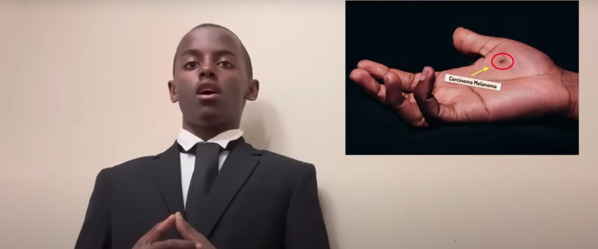 14-Year-Old Develops Skin Cancer Soap Cure and Wins Top Science Award