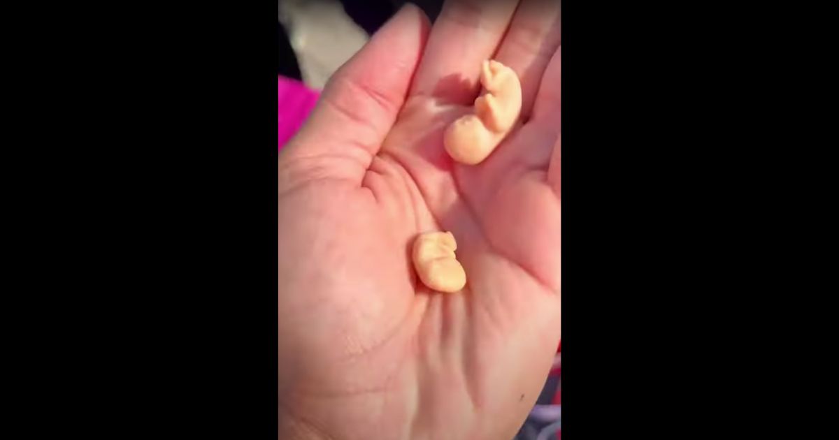 Watch: Abortion Activist Commits Truly Disgusting Act as Part of Mob Disrupting Pro-Life Campus Display
