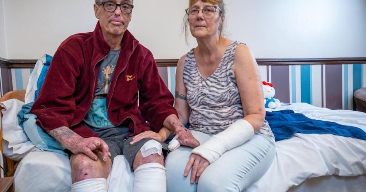 Grandfather Loses Both Legs and Most of His Fingers After Being Mouthed by Dog That Killed His Brother