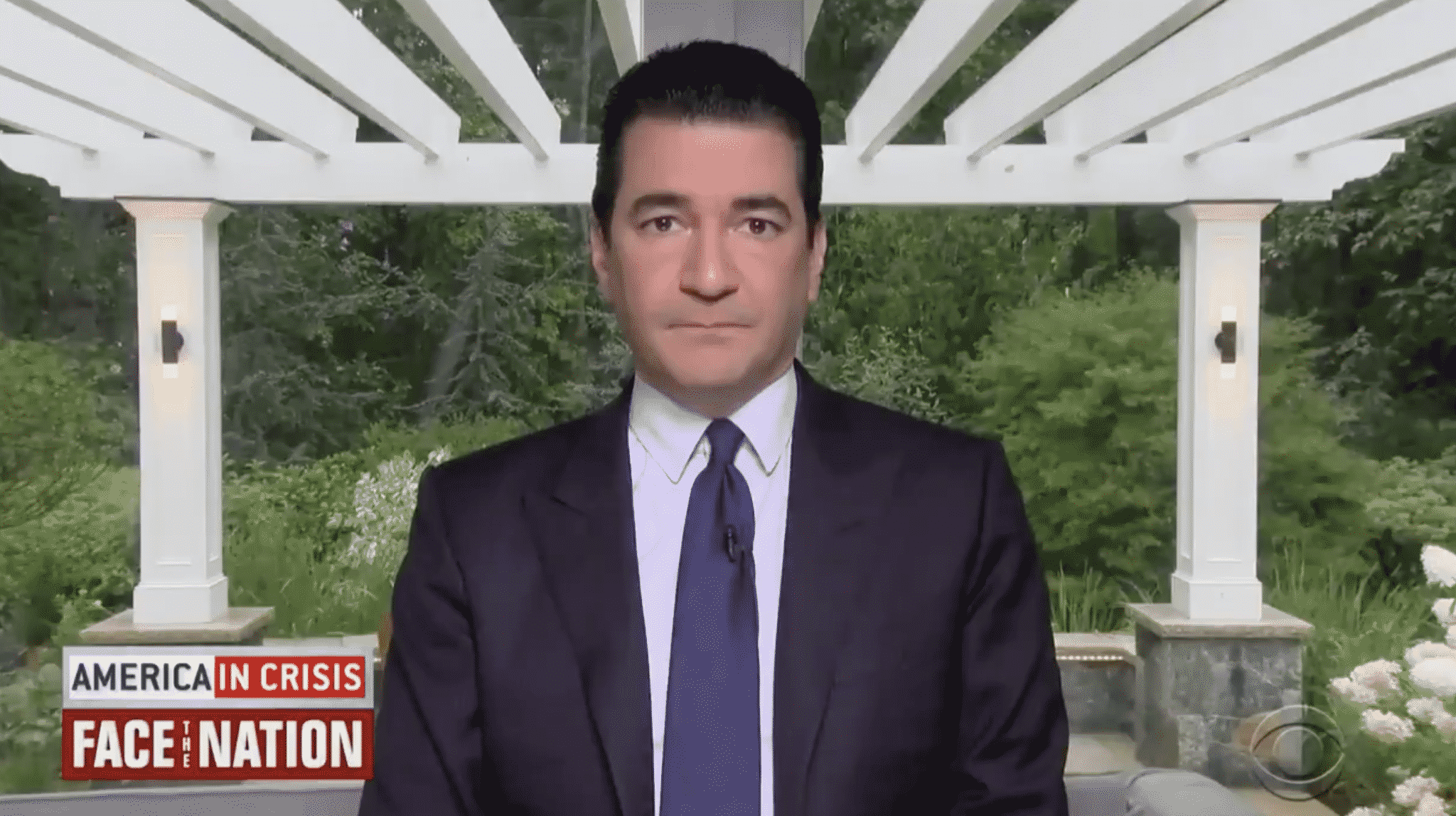Gottlieb Suggests Americans Should Be ‘Careful’ About Comparing the Coronavirus to the Flu
