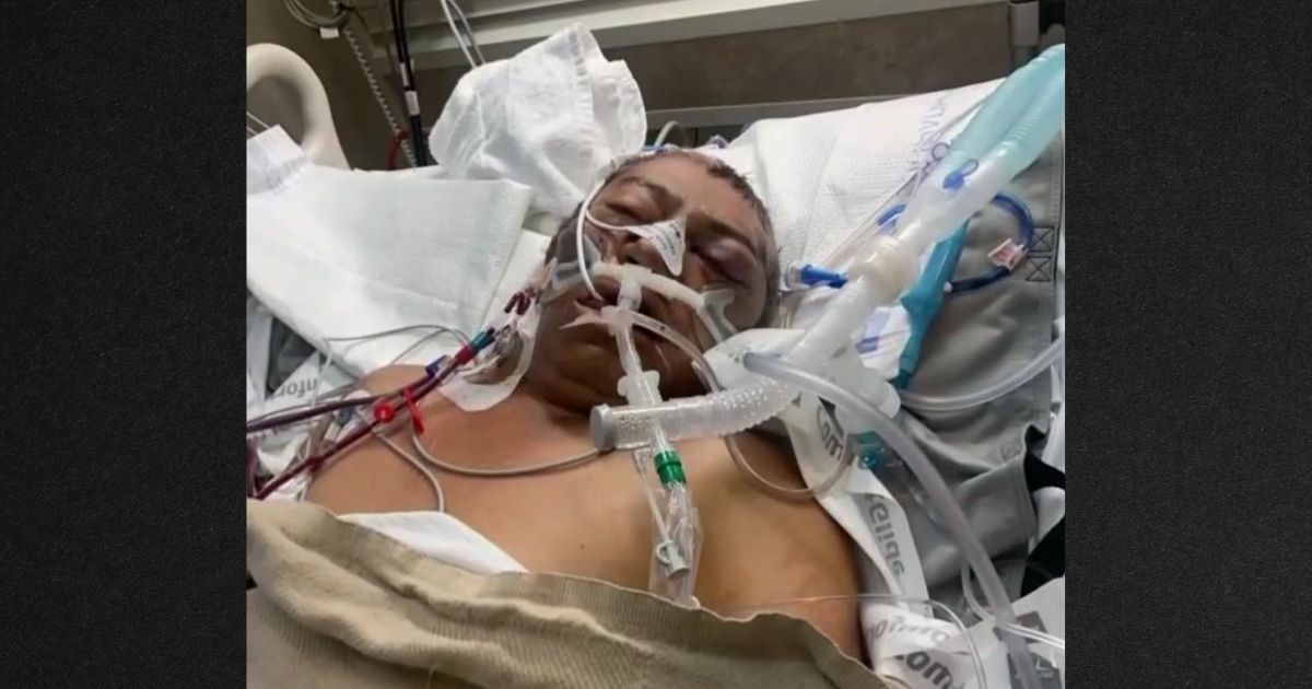 Sheriff Asking for Help with Investigation After Brutal Dog Attack that Left Man Without Legs
