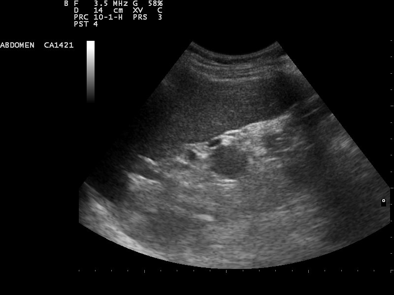 Red States Considering Sex Ed Bills That Would Require Students To Watch Pro-Life Video