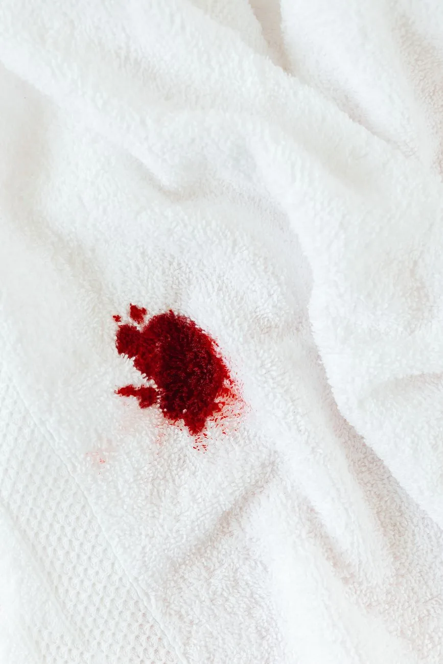 How to remove a red wine stain