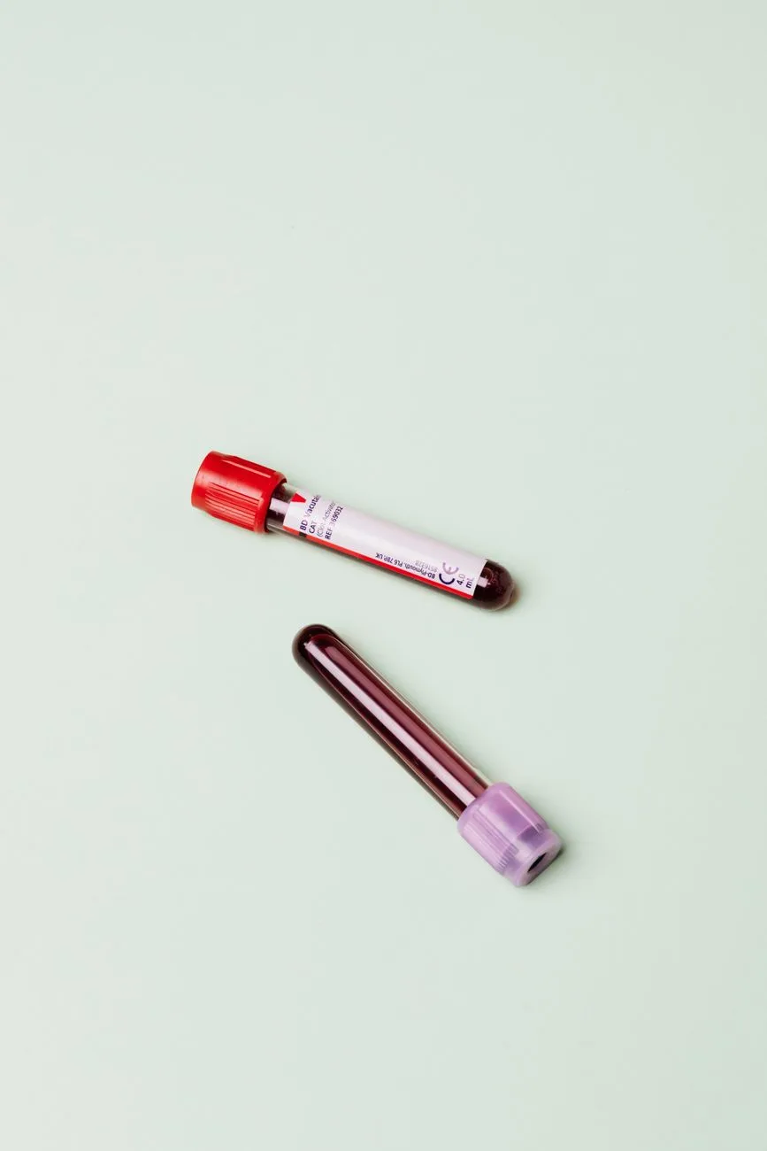 Lilly, Roche plan Alzheimer’s blood screening in Korea