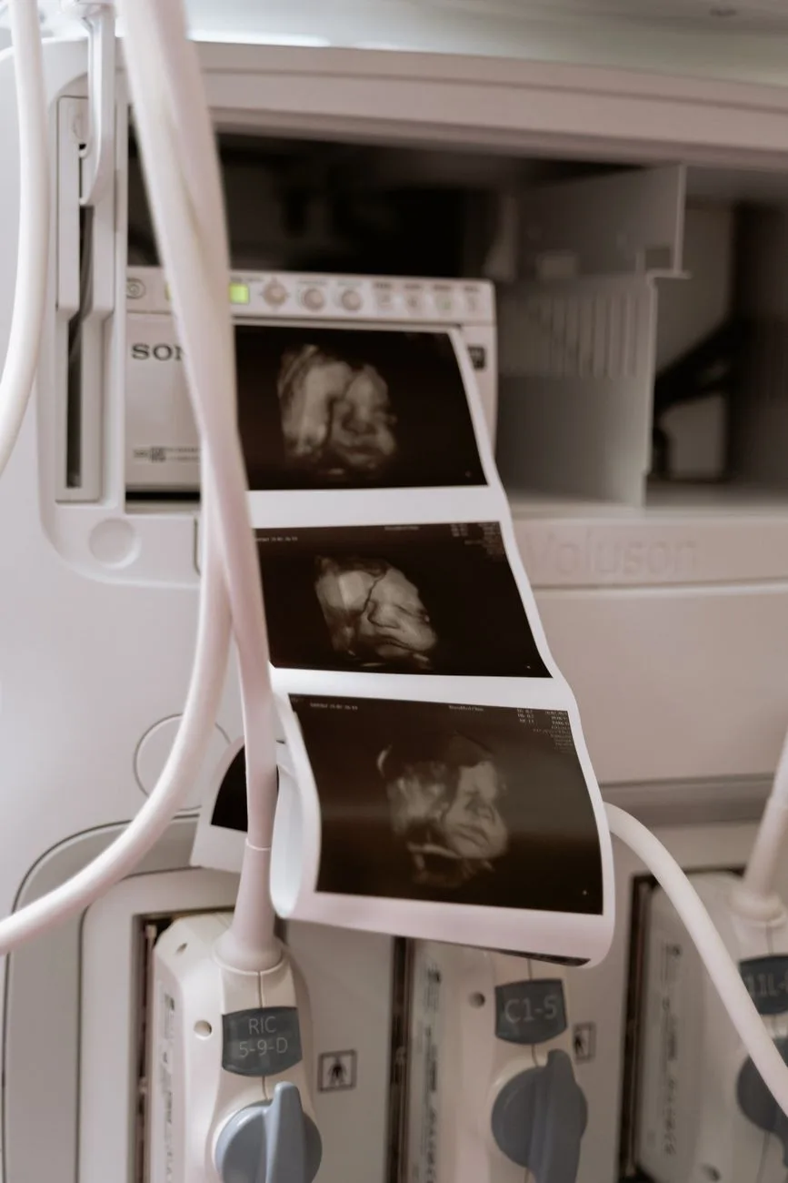 The Earlobe and the Unborn Child