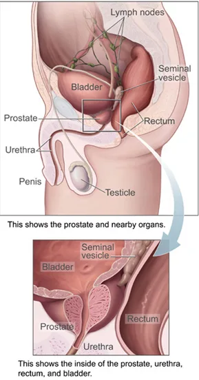 Experimental Prostate Drugs Show Early Responses