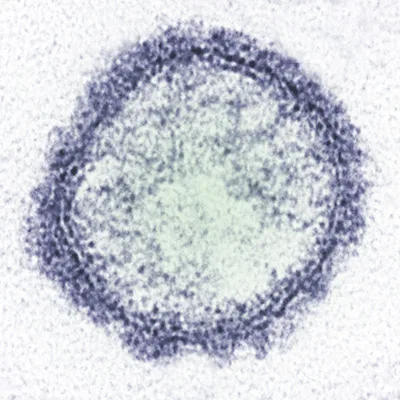 France reports first human Shamonda virus case