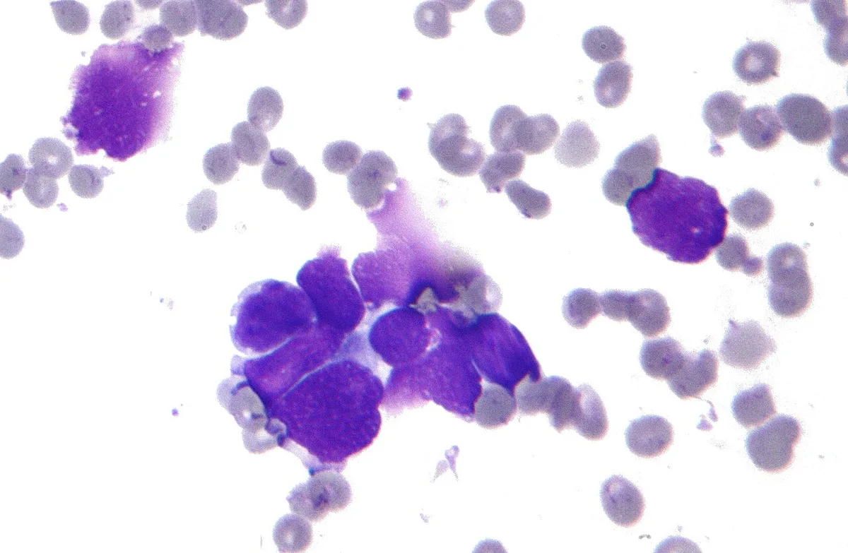 Amgen Reports Combo Cuts Lung Cancer Death Risk 58%